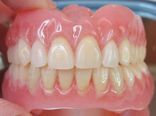 Young Dentures Before And After Crestline KS 66728